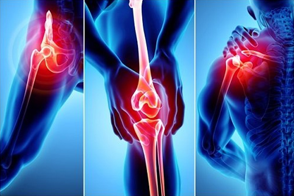 Joint Replacement