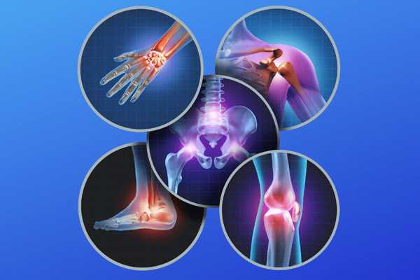 Do Not Ignore Persistent Joint Pain